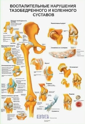 RUIYANMQ Holzpuzzle 1000 Teile Muskelsystem Anatomisches Poster Für Erwachsene Kinder Lernspielzeug Dekompressionsspiel Ju757Xa von RUIYANMQ