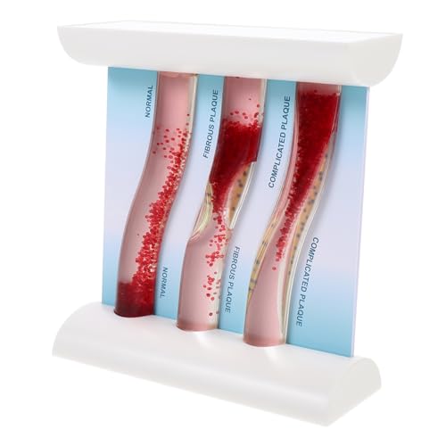 Amosfun Anatomisches Blutgefäßmodell Für Medizinische Ausbildung Lehrmodell Zur Darstellung Von Blutgefäßen Für Unterricht Die Studien Amosfun Anatomisches Blutgefäßmodell Für Medizinische Ausbildung Lehrmodell Zur Darstellung Von Blutgefäßen Für Unterricht Die Studien von Amosfun