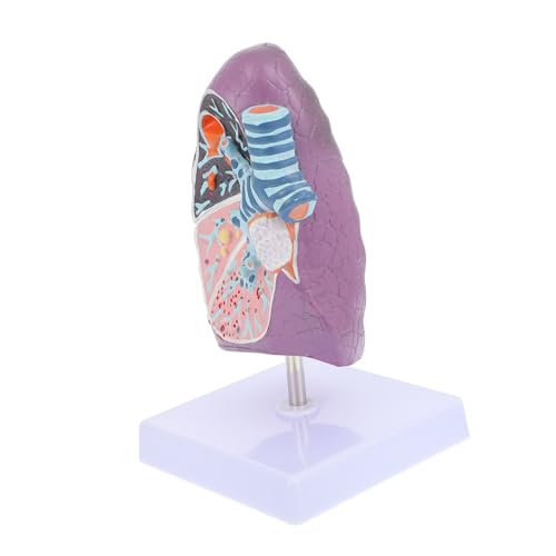 Amosfun Lungenmodellunterrichtshilfen Modell der rauchenden Lunge Anatomisches Modell der Lunge Anatomiemodell Lungenmodell für den Unterricht Modell Anatomie Plastik Amosfun Lungenmodellunterrichtshilfen Modell der rauchenden Lunge Anatomisches Modell der Lunge Anatomiemodell Lungenmodell für den Unterricht Modell Anatomie Plastik von Amosfun