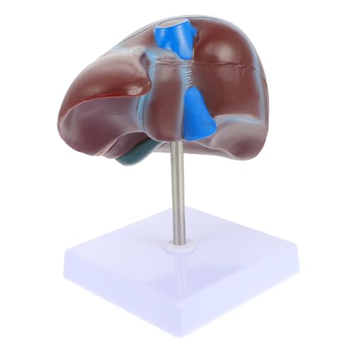 Anneome Medizinisches Lebermodell mit Sockel Anatomisches Menschliches Organmodell aus PVC Detaillierte Darstellung für Schul und Universitätsunterricht Lehrmittel für Medizinstudenten Anneome Medizinisches Lebermodell mit Sockel Anatomisches Menschliches Organmodell aus PVC Detaillierte Darstellung für Schul und Universitätsunterricht Lehrmittel für Medizinstudenten von Anneome