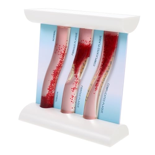 BESTYASH Anatomisches Blutgefäßmodell aus Dynamisches Medizinisches Lehrmodell für Arterien für Studenten und Fachkräfte Humanmedizin BESTYASH Anatomisches Blutgefäßmodell aus Dynamisches Medizinisches Lehrmodell für Arterien für Studenten und Fachkräfte Humanmedizin von BESTYASH