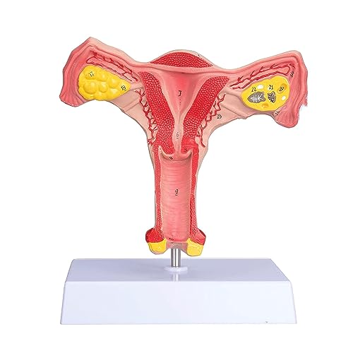 Ovarialmodell Vrouwelijk eierstokmodel Levensgroot menselijk baarmoeder- en eierstokmodel Vrouwelijk voortplantingsorgaanmodel voor studeren communicatie Gebärmuttermodell von BJQZX