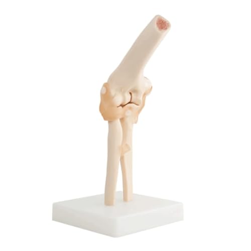 Menschliches Ellenbogengelenkmodell, medizinisches Anatomie-Skelett mit Bändern for das Medizinstudium im naturwissenschaftlichen Unterricht Menschliches Ellenbogengelenkmodell, medizinisches Anatomie-Skelett mit Bändern for das Medizinstudium im naturwissenschaftlichen Unterricht von CHENHOJU