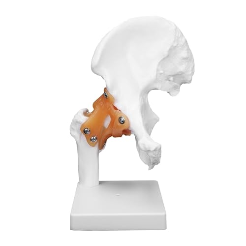 Menschliches Hüftgelenkmodell, anatomisches Bänderknochenmodell mit Spinalnerven for das Studium der menschlichen Anatomie Menschliches Hüftgelenkmodell, anatomisches Bänderknochenmodell mit Spinalnerven for das Studium der menschlichen Anatomie von CHENHOJU