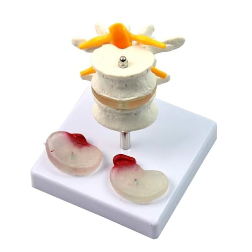 Menschliches Skelettmodell, medizinisches Lendenwirbelscheibenmodell, anatomische menschliche Wirbelsäule für pädagogisches Zugwerkzeug Menschliches Skelettmodell, medizinisches Lendenwirbelscheibenmodell, anatomische menschliche Wirbelsäule für pädagogisches Zugwerkzeug von CHENHOJU