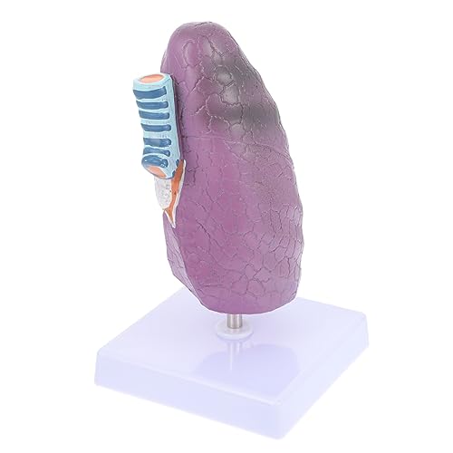 CIYODO Anatomisches Lungenmodell für Medizinische Ausbildung Pathologisches Lehrmodell Raucherlunge mit Detaillierten Merkmalen zur Atemwegsgesundheit für Studierende von CIYODO