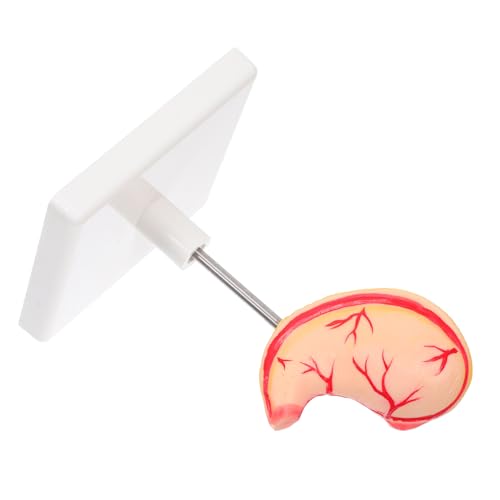 CIYODO Human Stomach Anatomy Modell Präzises Lehrmodell mit Detaillierter Darstellung Einfach Montierbar Robustes Material für Wissenschaftsunterricht und Klinische Trainings von CIYODO
