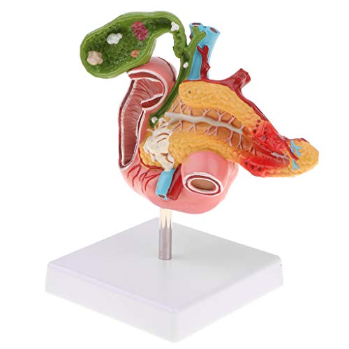 CUTICATE Menschliches Körpermodell 1: 1 Pankreas Modell für Anatomieunterricht CUTICATE Menschliches Körpermodell 1: 1 Pankreas Modell für Anatomieunterricht von CUTICATE