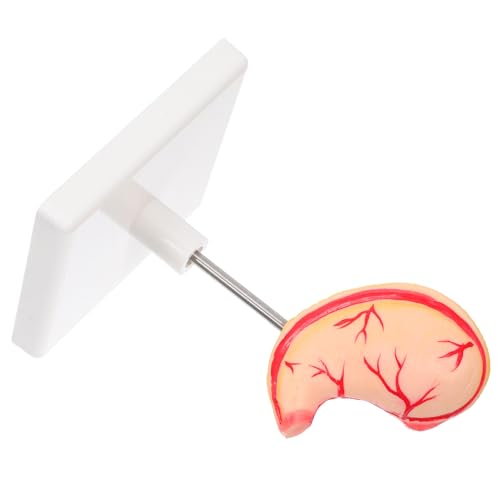 Cabilock Menschliches Magenmodell: Professionelles Magensektionsmodell Für Die Medizinische – Requisite Menschlicher Für Anatomieunterricht Und Demonstration Cabilock Menschliches Magenmodell: Professionelles Magensektionsmodell Für Die Medizinische – Requisite Menschlicher Für Anatomieunterricht Und Demonstration von Cabilock