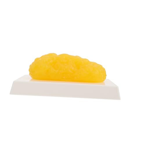 Cabilock Plastisches Anatomisches Fettmodell Realistische Oberfläche Demonstrationsmodell für Fitnessstudios und Ernährungswissenschaft Anschauliche Gewichtsverlustmotivation von Cabilock