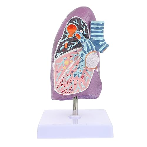 Ciieeo Lungenmodellunterrichtshilfen Modell Der Rauchenden Lunge Modell Anatomie Menschliches Lungenmodell Anatomisches Modell Der Lunge Lungenmodell Für Die Ausbildung Plastik Ciieeo Lungenmodellunterrichtshilfen Modell Der Rauchenden Lunge Modell Anatomie Menschliches Lungenmodell Anatomisches Modell Der Lunge Lungenmodell Für Die Ausbildung Plastik von Ciieeo