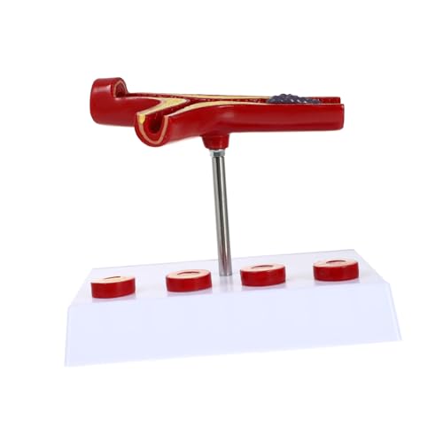 Ciieeo Medizinisches Lehrmodell Herz Kreislauf Modell aus Anatomisches Modell für Intravaskuläre Thrombose Arterielle Stenose für Lehrer Studenten zur Demonstration von Krankheitsbildern Ciieeo Medizinisches Lehrmodell Herz Kreislauf Modell aus Anatomisches Modell für Intravaskuläre Thrombose Arterielle Stenose für Lehrer Studenten zur Demonstration von Krankheitsbildern von Ciieeo