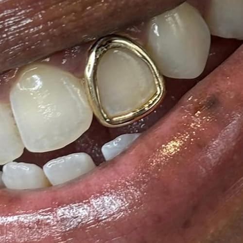 Comebachome Goldene Zähnekappen, 2pcs plattierte goldene Zähne Grillz für Frauen, Zahnkappe für Party Tänze Kostüm fröhliche Anlässe Comebachome Goldene Zähnekappen, 2pcs plattierte goldene Zähne Grillz für Frauen, Zahnkappe für Party Tänze Kostüm fröhliche Anlässe von Comebachome