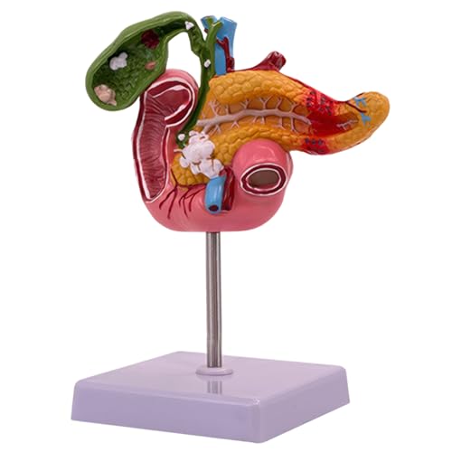 Csafyrt Modell des Verdauungssystems, Bildungs- und Lernen von Kindern Anatomie Spielzeug Medizinisches Verdauungssystem Anatomische Lehrmodelle für Kinder von Csafyrt