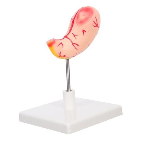 DECOMELODY Stabiles Magenmodell für Unterricht Anatomisches Verdauungsorgan Modell Einfach Montierbares Lehrmittel für Medizinische Ausbildung und Naturwissenschaftliche Klassen von DECOMELODY