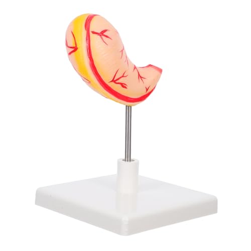 DIKACA Anatomisches Magenmodell Lehrmodell Stomach Training Model für Medizinische Ausbildung Klinische Schulung Einfach zu Montieren und Realistische Darstellung Menschlicher von DIKACA