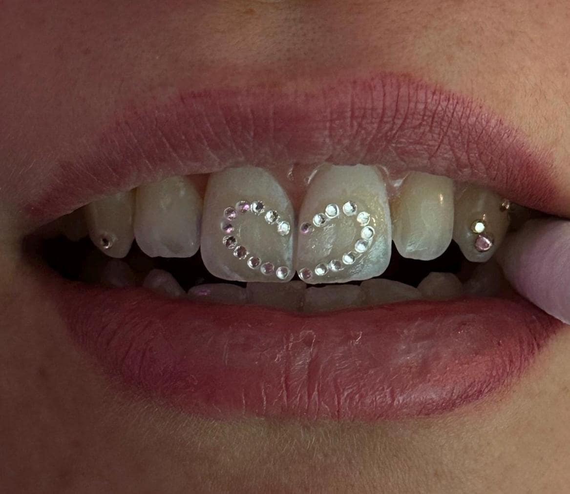 50x Kleinster Runde Kristall 1.2mm Tooth Gems Ideal Für Kreative Sets von Etsy - FairysToothGems