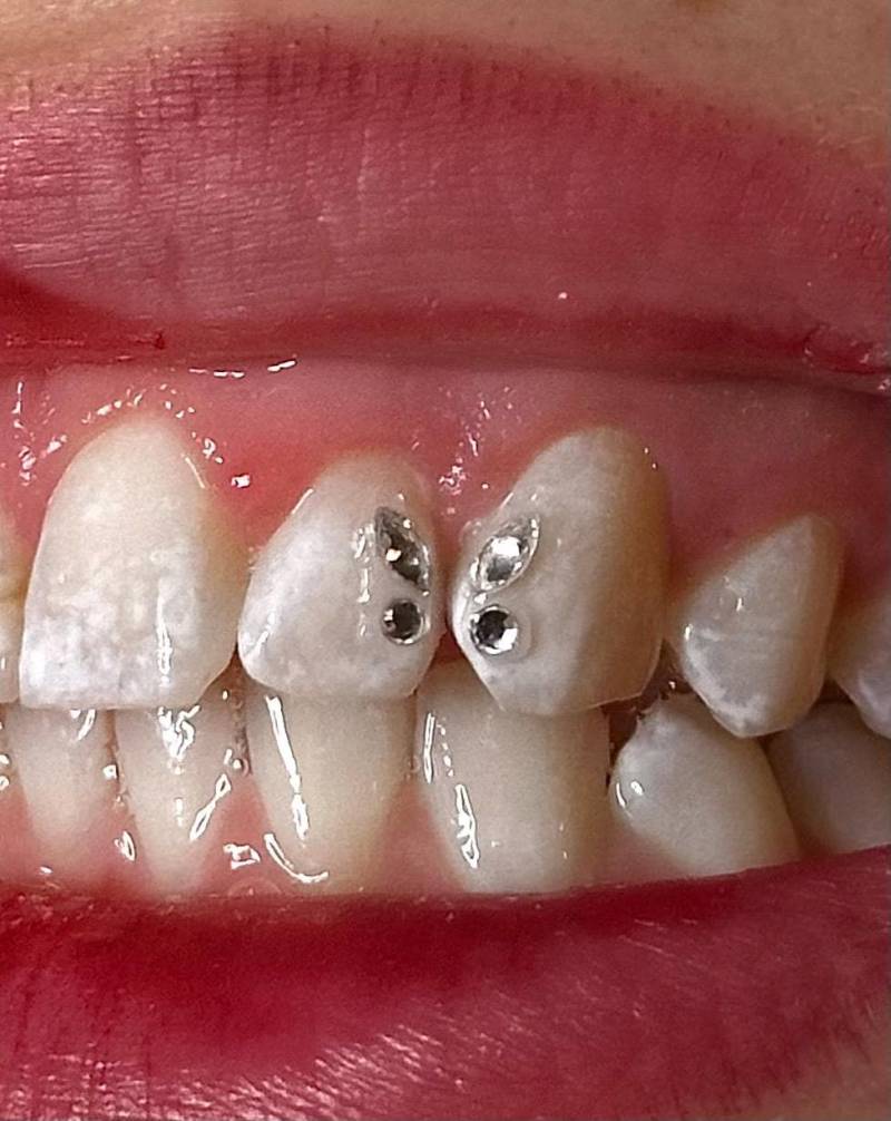 Micro/Kleiner Schmetterling Set Tooth Gems/ Zahnschmuck von Etsy - FairysToothGems