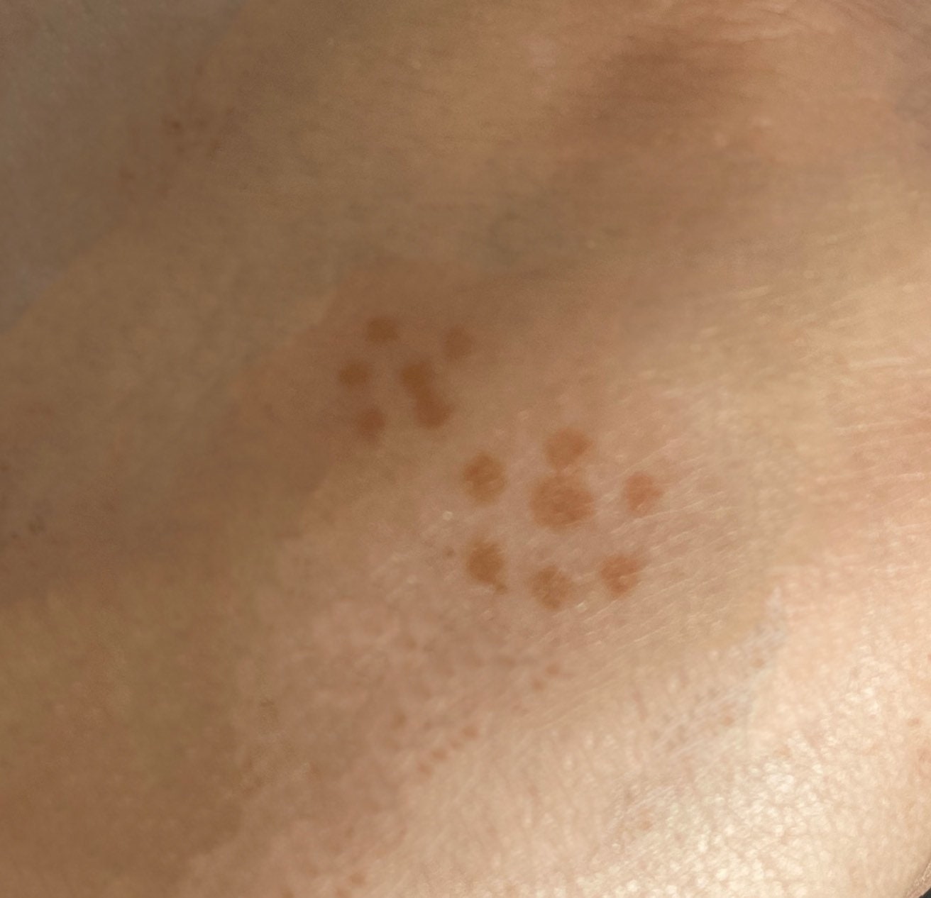 Hennatuben Für Sommersprossen, Henna Cones, Freckle Pen, Henna Freckles, Lebensechte Gefälschte Sommersprossen Sunkissed I Natur Hennatuben Für Sommersprossen, Henna Cones, Freckle Pen, Henna Freckles, Lebensechte Gefälschte Sommersprossen Sunkissed I Natur von Etsy - HennaDesignByHM