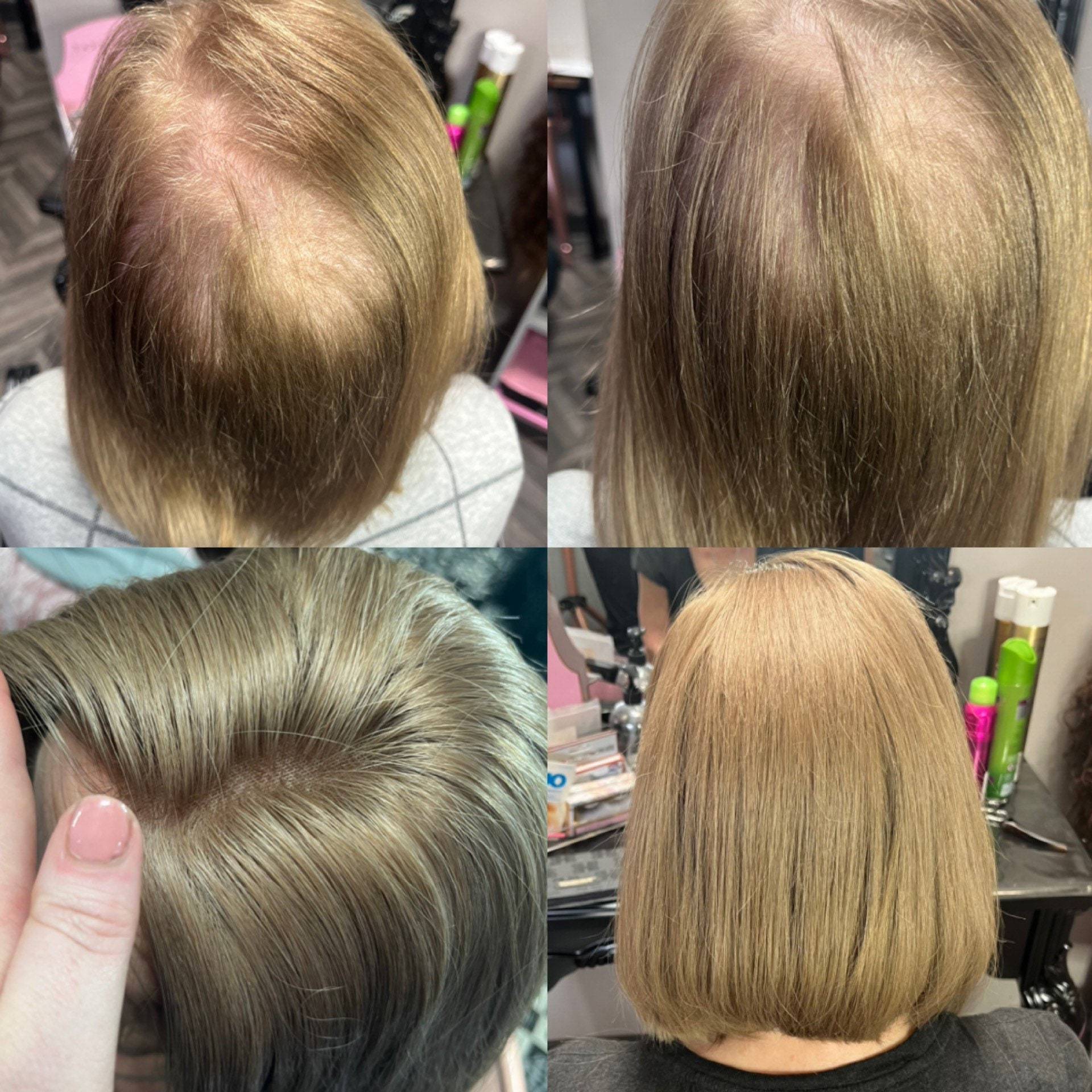 100% Echthaar Topper 5x5 Abdeckung Bereich - 4x4 Trennbereich Transparente Spitze 100% Echthaar Topper 5x5 Abdeckung Bereich - 4x4 Trennbereich Transparente Spitze von Etsy - MedusaHairCreations