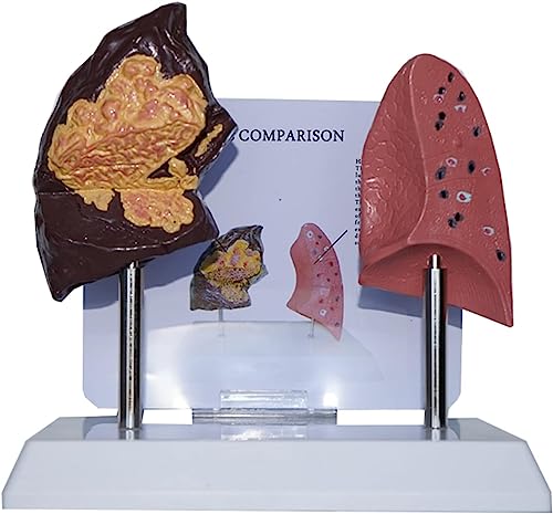 Lunge Anatomie Modell Menschliches Atmungssystem Modell, Rauchende Lunge und Normale Lunge Vergleich Anatomische Lehrmodelle für Wissenschaft Klassenzimmer und Studium. von ExKaTe