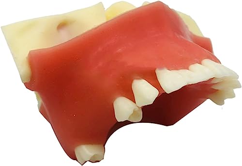 Zahnimplantat Zähne Modell, Kieferhöhle Lifting Modell, Oral Implantat Praxis Modell für Klasse Bildung und Studium Zähne Modell. Zahnimplantat Zähne Modell, Kieferhöhle Lifting Modell, Oral Implantat Praxis Modell für Klasse Bildung und Studium Zähne Modell. von ExKaTe