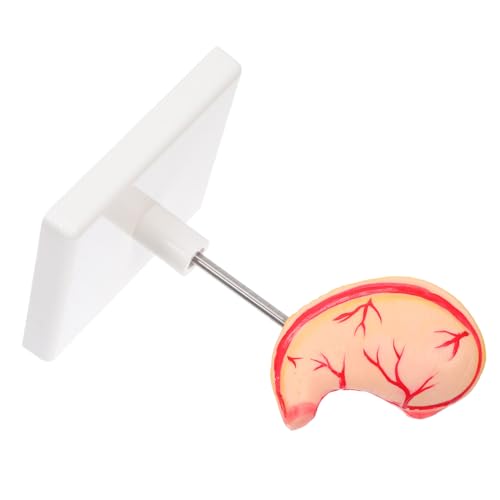FELTECHELECTR Human Stomach Anatomy Modell Hochpräzises Medizinisches Lehrmodell mit Realistischem Aufbau Detailreiche Darstellung für Medizinische Ausbildung Forschung und Klinisches Training von FELTECHELECTR