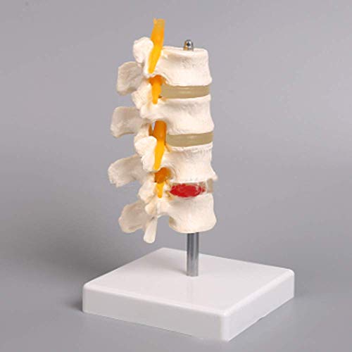 Lernmodell Menschliches Skelettmodell, 4-teiliges Modell der Lendenwirbelsäule, 11 x 11 x 17 cm, mit abnehmbarem Ständer für Skelettanatomie-Studien, Lehrdemonstration, medizinische Modelle von FFFHYIZH