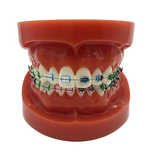 FHUILI Dental Typodont KFO-Demonstrationsmodell - Zähne Lehr-Modell - Behandlung Zähne Modell mit Metallhalterung - Bogendraht Modell Erklären mit Klammer für das Studium Lehr,A FHUILI Dental Typodont KFO-Demonstrationsmodell - Zähne Lehr-Modell - Behandlung Zähne Modell mit Metallhalterung - Bogendraht Modell Erklären mit Klammer für das Studium Lehr,A von FHUILI