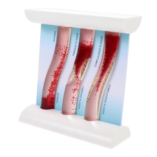 FUNOMOCYA Anatomisches Blutgefäßmodell aus Dynamisches Modell zur Darstellung von Arterien Lipoproteinen für Medizinische Lehre Bildung FUNOMOCYA Anatomisches Blutgefäßmodell aus Dynamisches Modell zur Darstellung von Arterien Lipoproteinen für Medizinische Lehre Bildung von FUNOMOCYA
