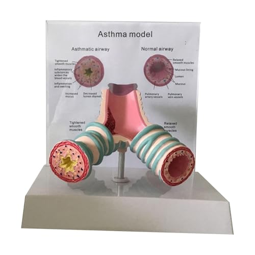 FYYYSLKX Anatomisches Modell des Menschlichen Asthmas - Bronchialmodell des Atmungssystems for Studenten, Lerndisplay, Lehrmodell von FYYYSLKX