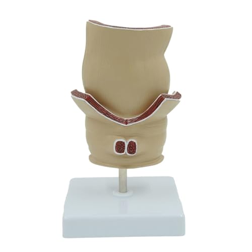 Simulationsmodell For Die Physiologische Rektalpathologie, Rektummodell, Menschliches Rektumgeschwür, Akne-Pathologiemodell, Hämorrhoidenmodell Zur Demonstration Anorektaler Erkrankungen Simulationsmodell For Die Physiologische Rektalpathologie, Rektummodell, Menschliches Rektumgeschwür, Akne-Pathologiemodell, Hämorrhoidenmodell Zur Demonstration Anorektaler Erkrankungen von FYYYSLKX