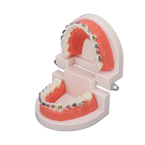 Zahn Demonstrationsmodell, Zähne Dental Demonstrationsmodell, Dental Typodont Zähne Modell mit kieferorthopädischen Metallklammer für Zahnarzt Lehre Forschung Dental Zahn Demonstrationsmodell, Zähne Dental Demonstrationsmodell, Dental Typodont Zähne Modell mit kieferorthopädischen Metallklammer für Zahnarzt Lehre Forschung Dental von Fyearfly