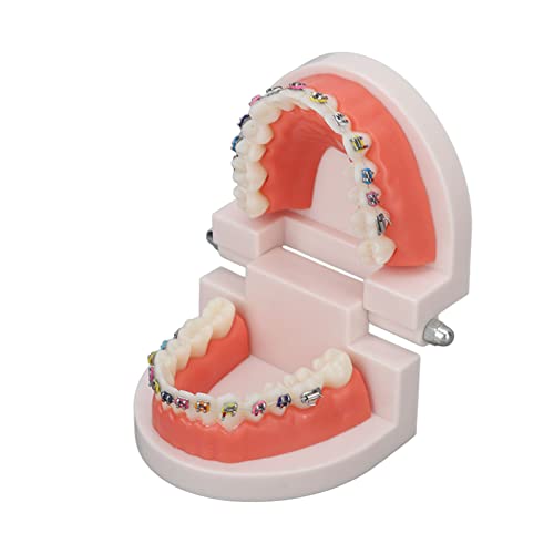 Zahn Demonstrationsmodell, Zähne Dental Demonstrationsmodell, Dental Typodont Zähne Modell mit kieferorthopädischen Metallklammer für Zahnarzt Lehre Forschung Dental von Fyearfly