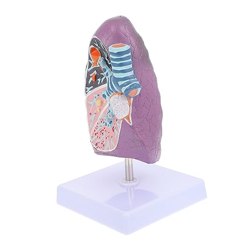 GLEAVI Modell einer erkrankten Lunge Lungenmodell Anatomiemodell Lunge Modell der Lungenanatomie Modell der rauchenden Lunge anatomisches Modell Pathologisches Modell Plastik von GLEAVI