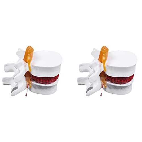 2 x menschliche Anatomie, Skelett, Wirbelsäule, Lendenwirbelsäule, Bandscheibenvorfall, Lehrmodell, Gehirn, Schädel, traumatisches Schulbedarf, Instrume 2 x menschliche Anatomie, Skelett, Wirbelsäule, Lendenwirbelsäule, Bandscheibenvorfall, Lehrmodell, Gehirn, Schädel, traumatisches Schulbedarf, Instrume von GUIJIALY