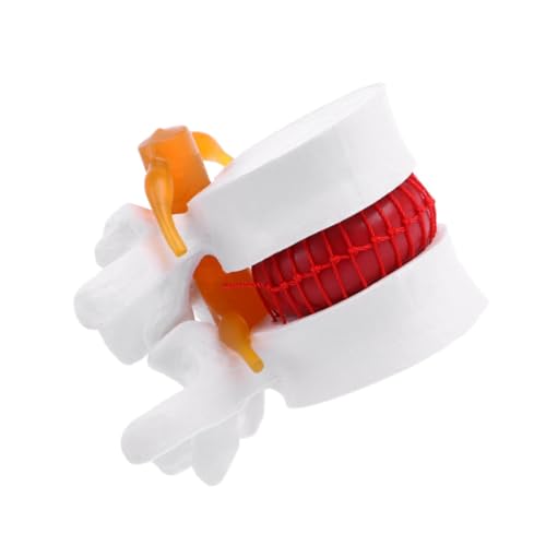1Stk Modell der menschlichen Wirbelsäule Erweiterung Zähne Mannequin Puppe Modelle Wirbelsäulenmodell für den Unterricht Wirbelsäulenmodell für Arzt Weiß Bandscheiben Schimmel PVC von Gatuida