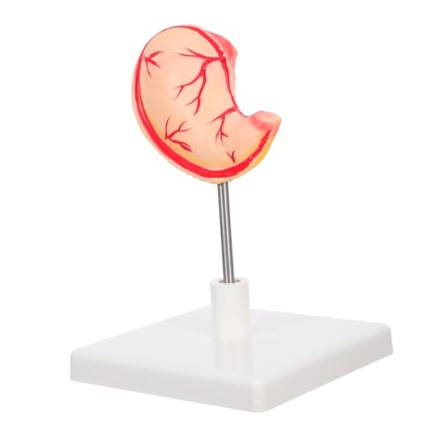 Gatuida Realistisches Magenmodell Hochpräzises Anatomisches Modell mit Detailgetreuer Struktur Einfach Montierbar als Medizinisches Lehrmittel für Studenten Forschung und Klinische von Gatuida