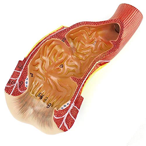 Anatomisches Modell Der Struktur des Menschlichen Rektums, Analkanals Und Anus - Medizinisch-Anatomisches - PVC-Material - Anorektale Chirurgie von Generic