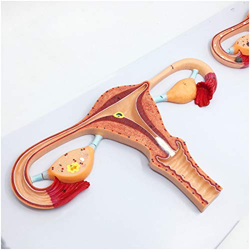 Anatomisches Modell des Eizellbefruchtungsprozesses - Demonstrationsmodell Zur Weiblichen Eizellbefruchtung - 2-Fach Vergrößertes Modell Zur Eizellentwicklung Anatomisches Modell des Eizellbefruchtungsprozesses - Demonstrationsmodell Zur Weiblichen Eizellbefruchtung - 2-Fach Vergrößertes Modell Zur Eizellentwicklung von Generic