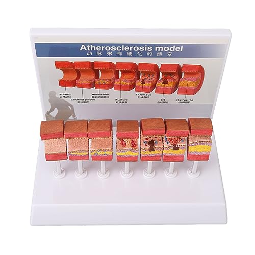 Generic Anatomie -Replikmodell, 7 PCs Menschlicher Körper Spielen Aadmodel Schöne Handfarbe Realistische Simulation Leuchtende Farben für Lernwerkzeuge von Generic