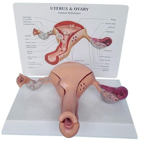 Generisch Vagina Ovar Uterus Anatomisches Modell, Montage Human Uterus Modell, Ovarien und Uterus Pathologien Modell von Generisch