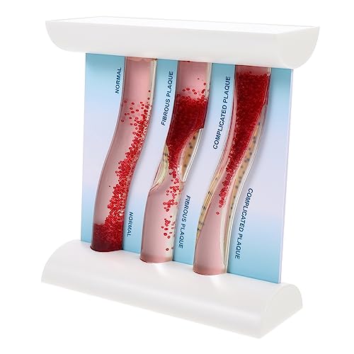 HEALEEP Anatomisches Modell für Lehrzwecke Blutgefäß Simulationsmodell zur Veranschaulichung von Atherosklerose Cholesterinaufbau im Unterricht Arztpraxen HEALEEP Anatomisches Modell für Lehrzwecke Blutgefäß Simulationsmodell zur Veranschaulichung von Atherosklerose Cholesterinaufbau im Unterricht Arztpraxen von HEALEEP