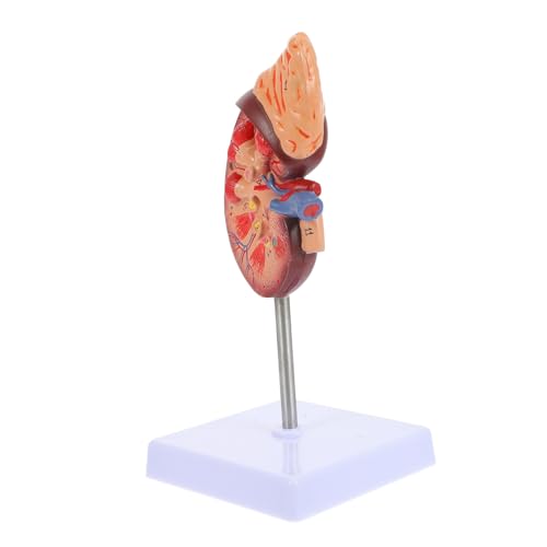 HEALSOPTHY Nierenmodell Schulmodell Nieren-Unterrichtsmodell Nieren-Präsentationsmodell Biologie Demonstrationsmodell Anatomiemodell Biologieunterricht menschliche Nierenstütze PVC von HEALSOPTHY