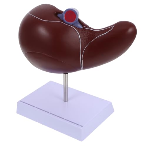 HIAKDOFT Medizinisches Anatomisches Lebermodell mit Sockel Realistisches Human Liver Teaching Model aus Kunststoff für Medizinische Ausbildung Schule Pflege und Gesundheitsschulen von HIAKDOFT
