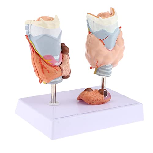 Harilla Vergrößerte Schilddrüsen Modell Hyperthyreoidismus Modell Human Schilddrüse Anatomisches Modellsatz, Normales Und Erkranktes Modell mit Sta von Harilla