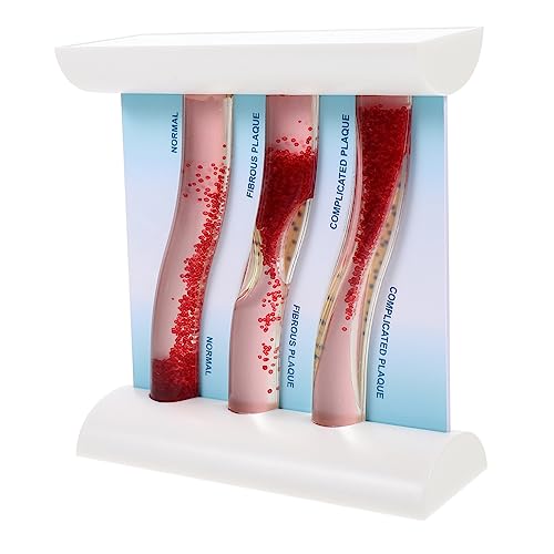 Homoyoyo Anatomisches Modell Blutgefäße Lehrmodell für Medizinische Ausbildung Realistische Darstellung von Cholesterinspiegel Gefäßerkrankungen für Studenten Homoyoyo Anatomisches Modell Blutgefäße Lehrmodell für Medizinische Ausbildung Realistische Darstellung von Cholesterinspiegel Gefäßerkrankungen für Studenten von Homoyoyo