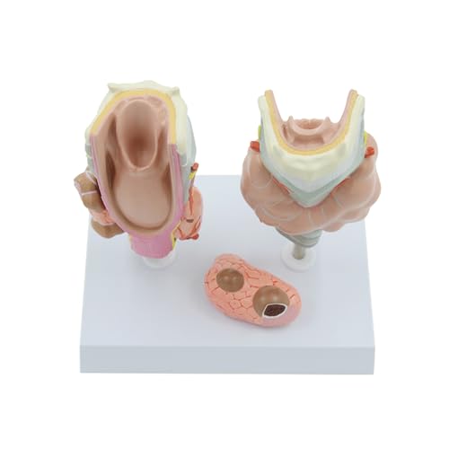 1 Satz Schilddrüse Erkrankte Modell Schilddrüse Anatomische Menschliche Anatomie Medizinische Lehre Bildungs ​​Ausrüstung Pathologische Modell von Huhpa