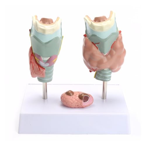 1 Satz menschliches anatomisches Schilddrüsenpathologie-Anatomie-Lehrmodell von Huhpa