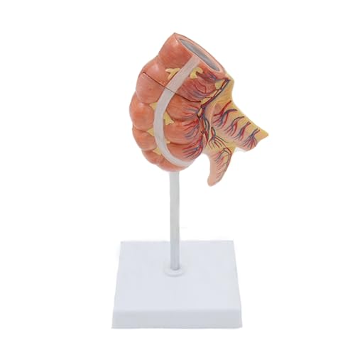 1 Stück 1:1 Lebensgroße menschliche Blinddarm- und Blinddarmmodelle Viszerales anatomisches medizinisches Lehrmodell von Huhpa